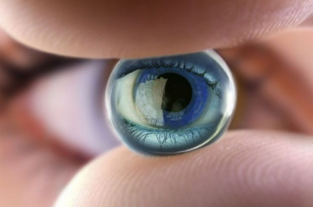 Contact lenses visits